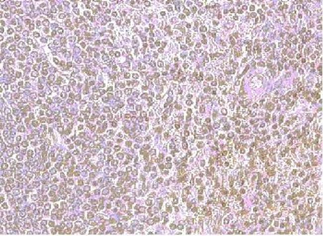 CXCR4 Antibody in Immunohistochemistry (Paraffin) (IHC (P))