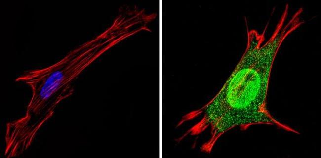 THRA Antibody in Immunocytochemistry (ICC/IF)