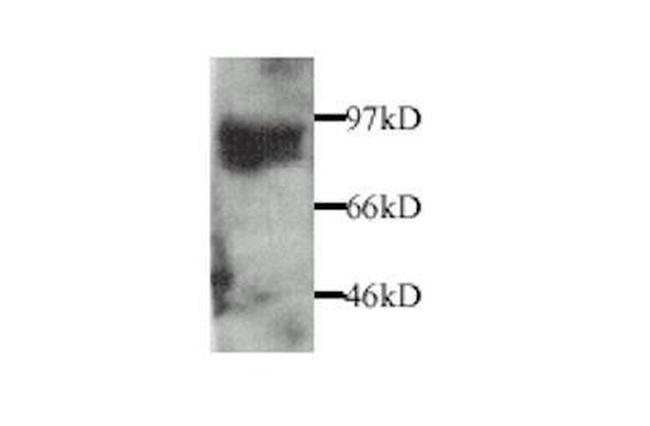 MMP9 Antibody in Western Blot (WB)