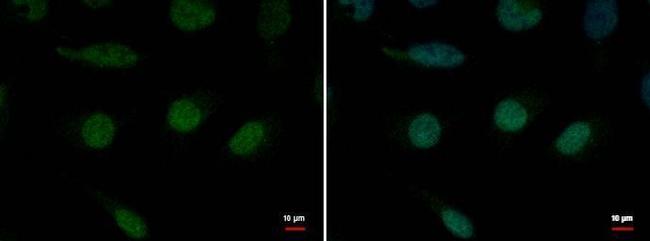 XPB Antibody in Immunocytochemistry (ICC/IF)