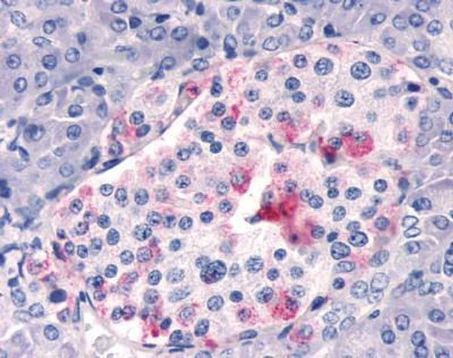 RSV strain A2 Antibody in Immunohistochemistry (IHC)