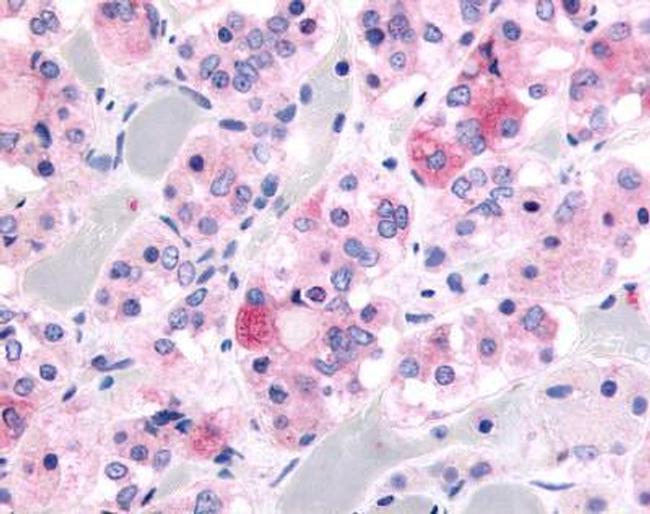 Kallikrein 9 Antibody in Immunohistochemistry (IHC)