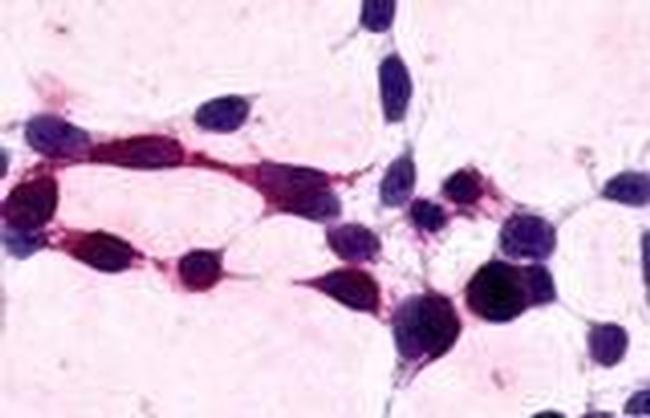 XPR1 Antibody in Immunocytochemistry (ICC/IF)