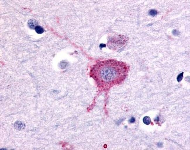 mGluR2 Antibody in Immunohistochemistry (Paraffin) (IHC (P))