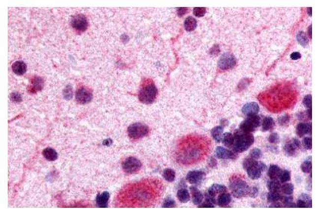 OPRK1 Antibody in Immunohistochemistry (Paraffin) (IHC (P))