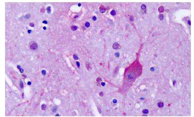 mGluR4 Antibody in Immunohistochemistry (Paraffin) (IHC (P))