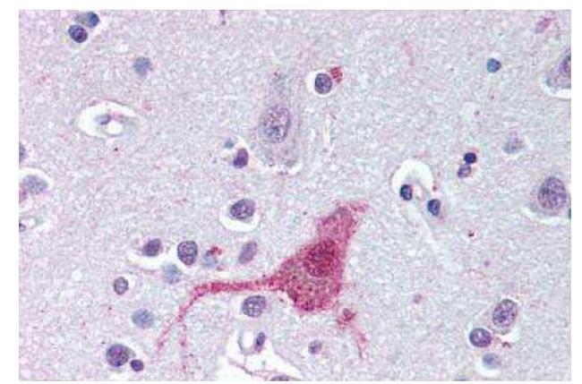 Endothelin B Receptor Antibody in Immunohistochemistry (Paraffin) (IHC (P))