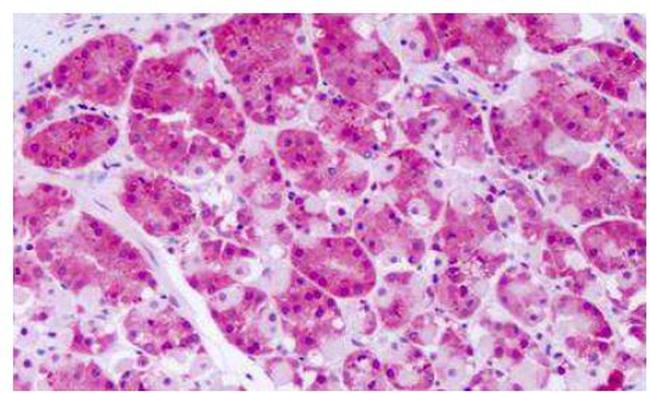 PRKD2 Antibody in Immunohistochemistry (Paraffin) (IHC (P))