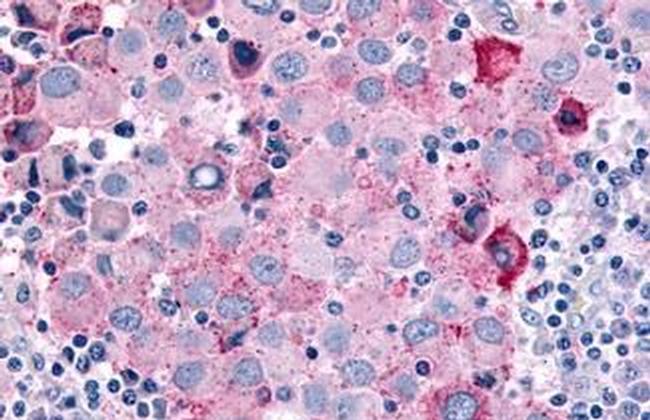 Cdc7 Antibody in Immunohistochemistry (Paraffin) (IHC (P))