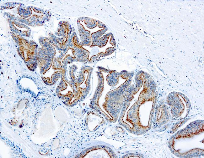 AMACR Antibody in Immunohistochemistry (Paraffin) (IHC (P))