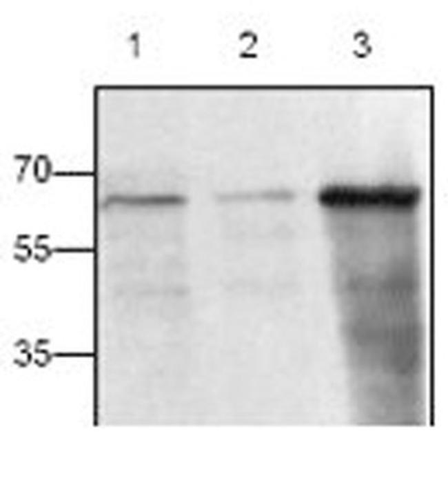 CD154 (CD40 Ligand) Antibody in Western Blot (WB)