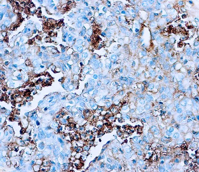 Human Serum Albumin Antibody in Immunohistochemistry (Paraffin) (IHC (P))