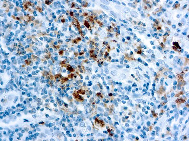 Granzyme B Antibody in Immunohistochemistry (Paraffin) (IHC (P))