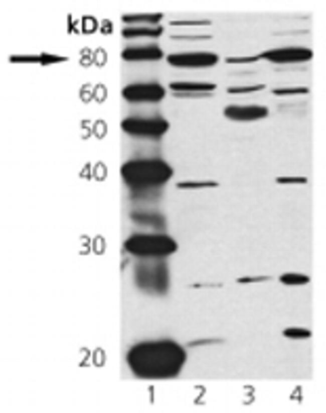 cGKI Antibody in Western Blot (WB)