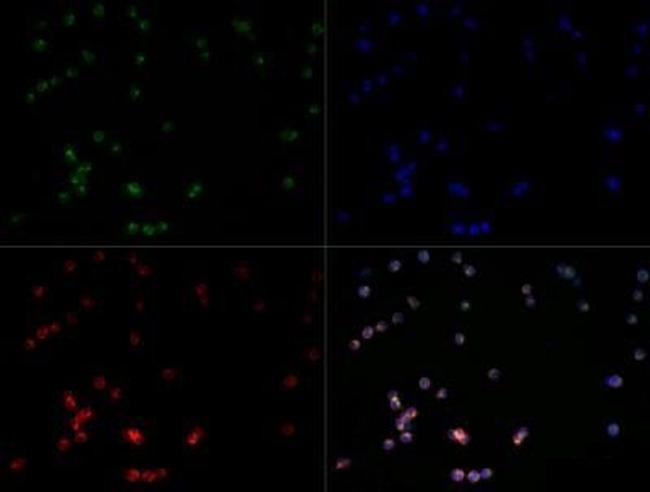 TLR7 Antibody in Immunocytochemistry (ICC/IF)