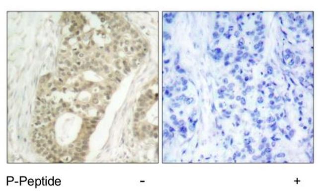 Phospho-PKC delta (Ser645) Antibody in Immunohistochemistry (Paraffin) (IHC (P))