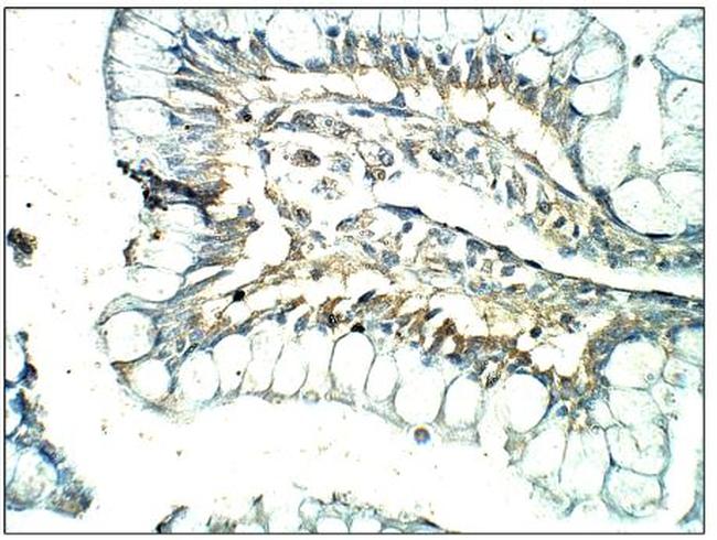 CXCR7 Antibody in Immunohistochemistry (Paraffin) (IHC (P))