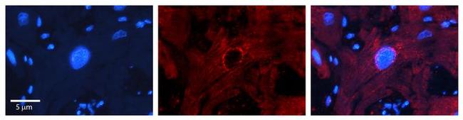 MBD2 Antibody in Immunohistochemistry (Paraffin) (IHC (P))