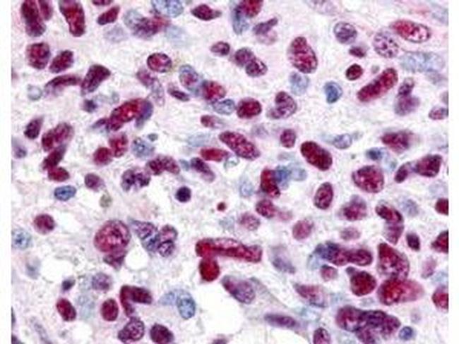 GLI3 Antibody in Immunohistochemistry (Paraffin) (IHC (P))