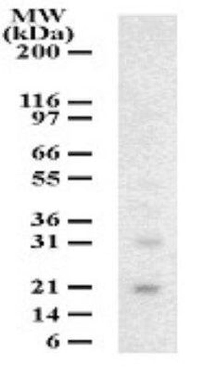 DUT Antibody in Western Blot (WB)