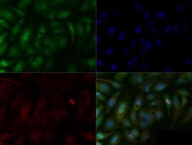 SMAD6 Antibody in Immunocytochemistry (ICC/IF)