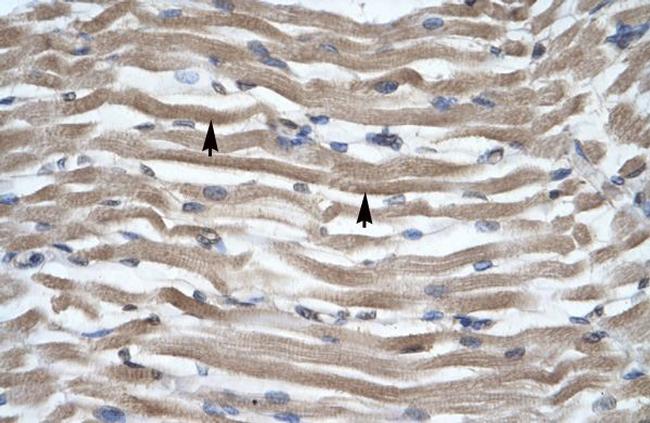 DLX2 Antibody in Immunohistochemistry (Paraffin) (IHC (P))