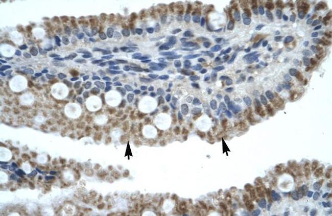 ZNF683 Antibody in Immunohistochemistry (Paraffin) (IHC (P))