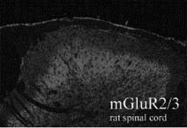 mGluR2/mGluR3 Antibody in Immunohistochemistry (IHC)