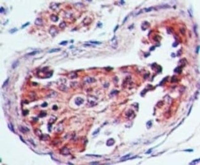 HTR3A Antibody in Immunohistochemistry (Paraffin) (IHC (P))