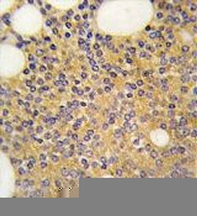 PRMT3 Antibody in Immunohistochemistry (Paraffin) (IHC (P))