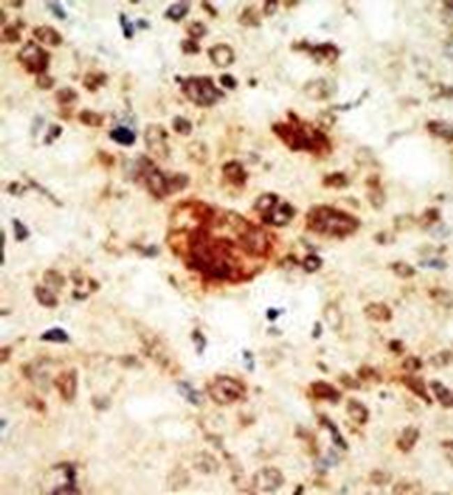 EphA1 Antibody in Immunohistochemistry (Paraffin) (IHC (P))