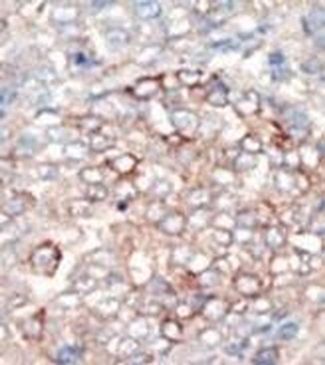 PIK3R4 Antibody in Immunohistochemistry (Paraffin) (IHC (P))