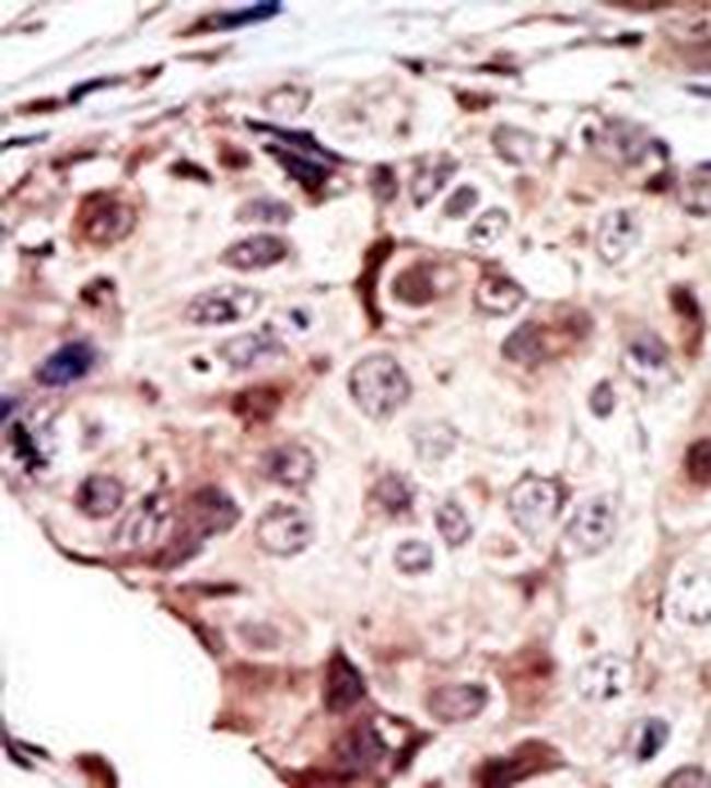 RYK Antibody in Immunohistochemistry (Paraffin) (IHC (P))