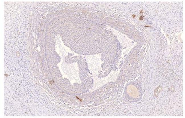 PDE4D Antibody in Immunohistochemistry (Paraffin) (IHC (P))