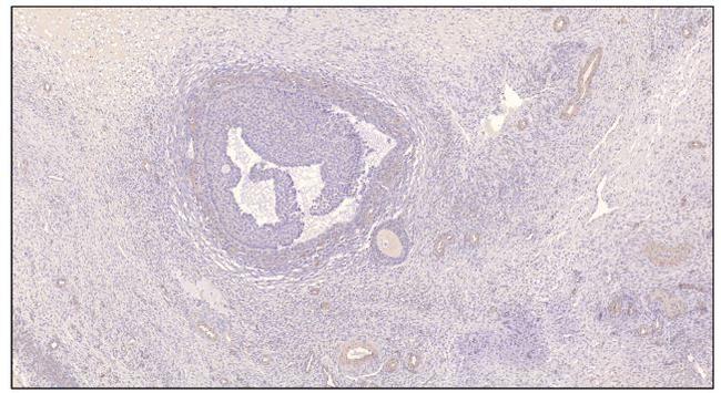 PDE7B Antibody in Immunohistochemistry (IHC)