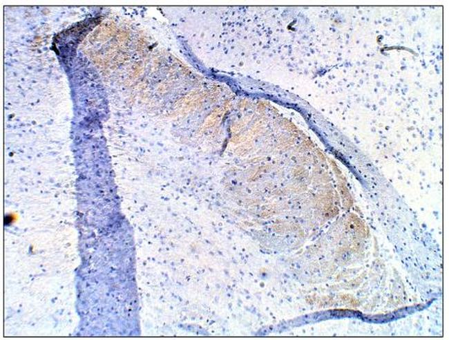 PDE10A Antibody in Immunohistochemistry (Paraffin) (IHC (P))