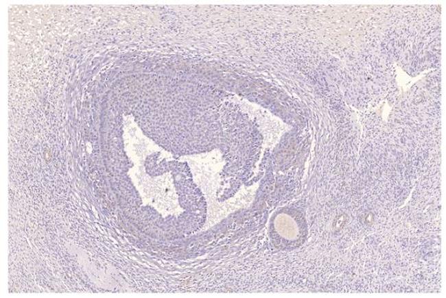 PDE11A Antibody in Immunohistochemistry (IHC)