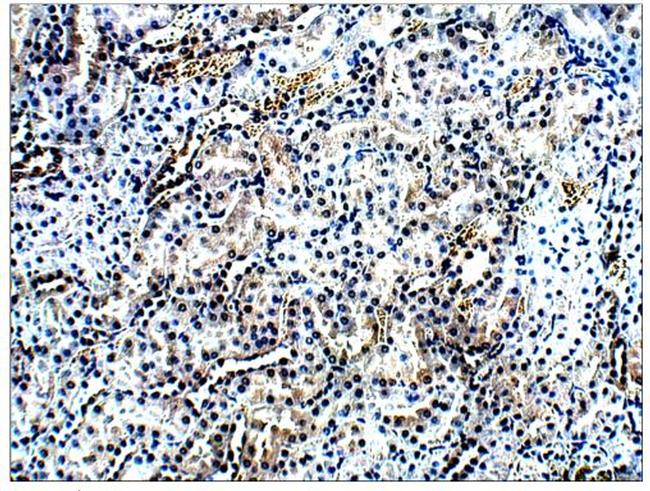 AMACR Antibody in Immunohistochemistry (Paraffin) (IHC (P))