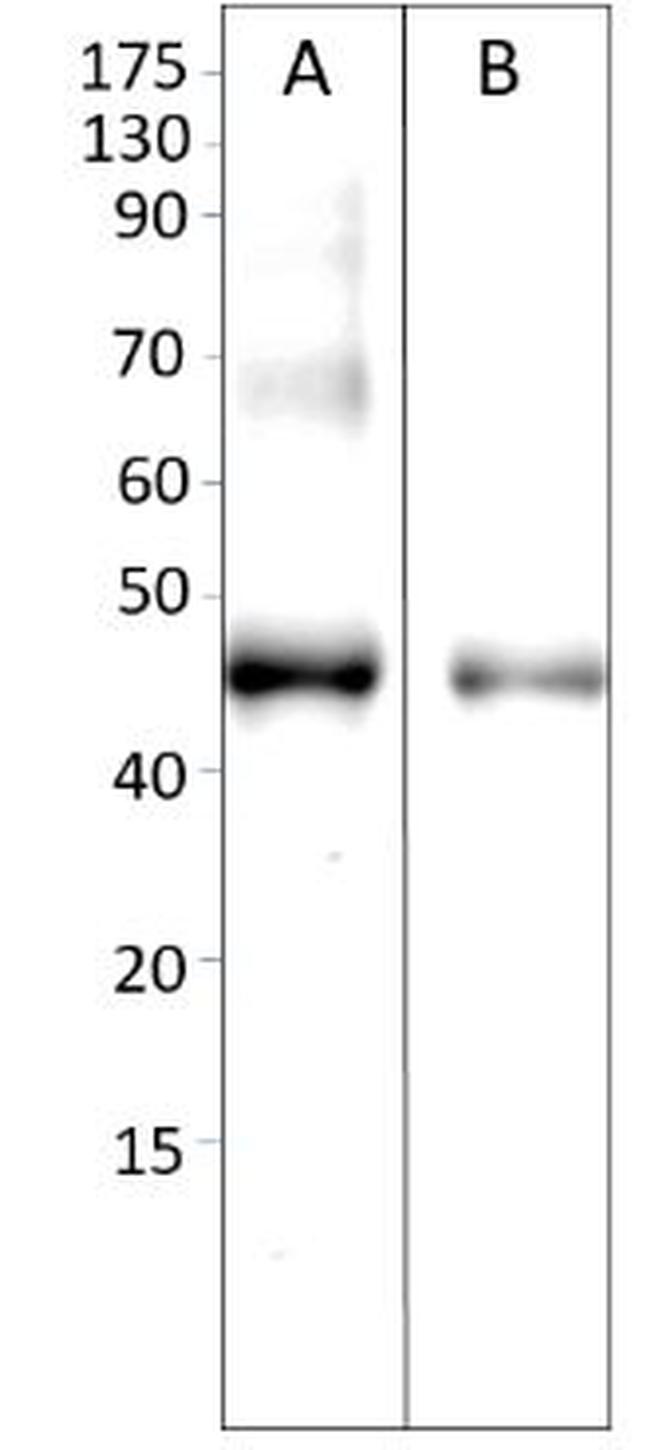 AMACR Antibody in Western Blot (WB)