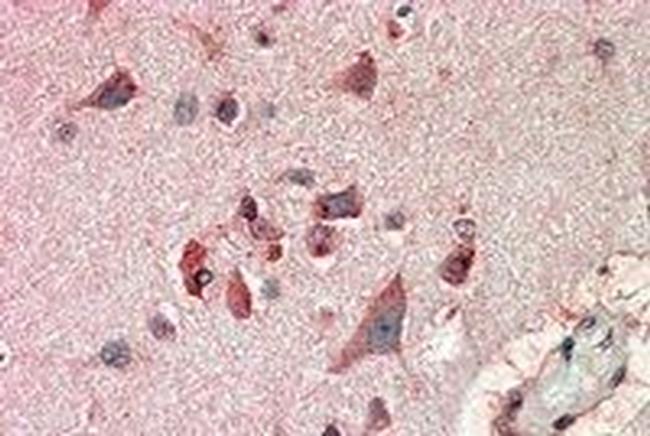 FBXL2 Antibody in Immunohistochemistry (Paraffin) (IHC (P))