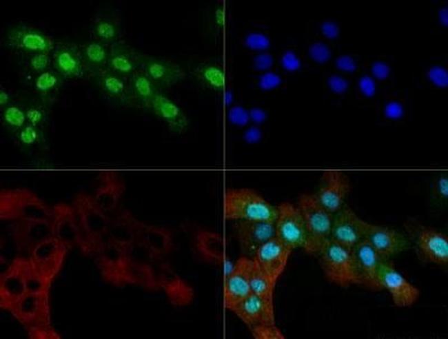 OGG1 Antibody in Immunocytochemistry (ICC/IF)