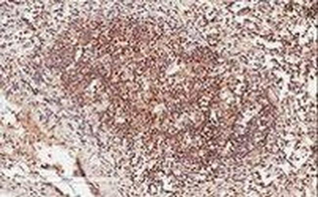 GRB2 Antibody in Immunohistochemistry (Paraffin) (IHC (P))