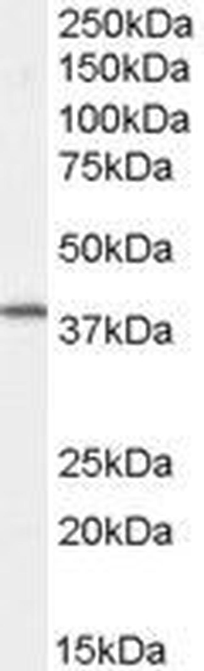 Dysadherin Antibody in Western Blot (WB)