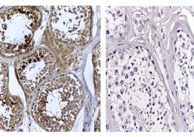 DNMT3L Antibody in Immunohistochemistry (IHC)