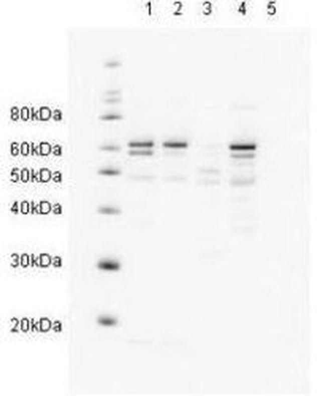 RAD23A Antibody in Western Blot (WB)