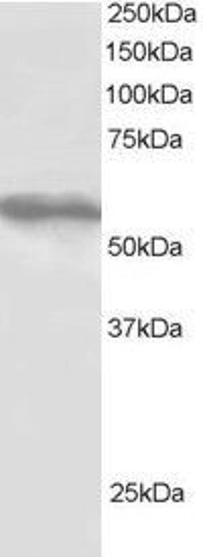 TRIM4 Antibody in Western Blot (WB)