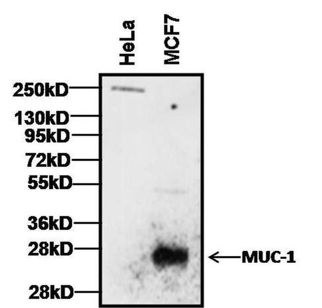 Armenian Hamster IgG (H+L) Secondary Antibody in Western Blot (WB)