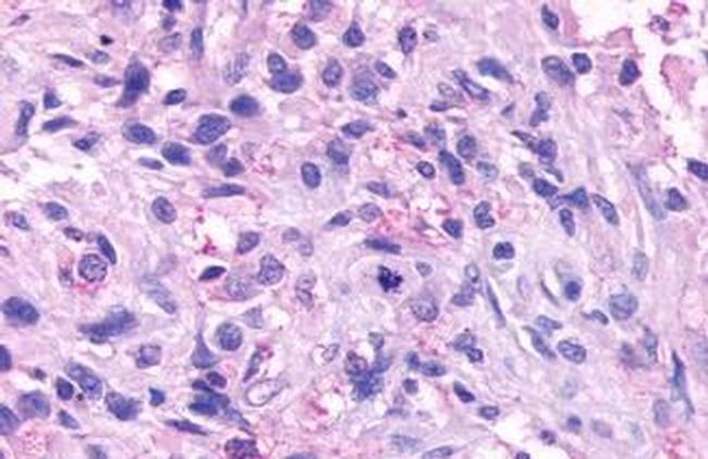 NPBWR1 Antibody in Immunohistochemistry (Paraffin) (IHC (P))