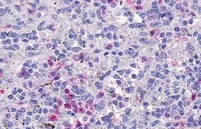 GPR109B Antibody in Immunohistochemistry (Paraffin) (IHC (P))