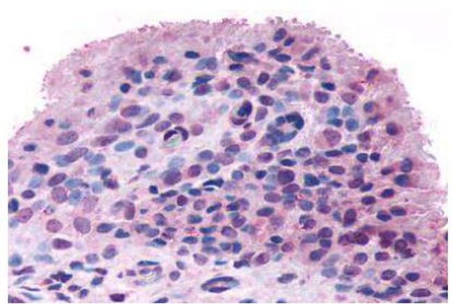 FZD5 Antibody in Immunohistochemistry (Paraffin) (IHC (P))